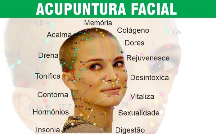 Acupuntura _site.jpg